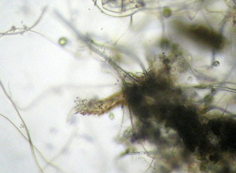 Ciliato con tana: Stichotricha secunda ?